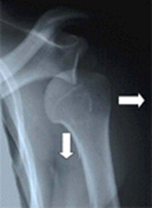 &Epsilon;&xi;ά&rho;&theta;&rho;&eta;&mu;&alpha; Ώ&mu;&omicron;&upsilon;