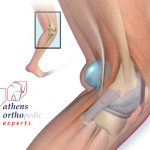 &chi;ό&nu;&delta;&rho;&iota;&nu;&epsilon;&sigmaf; &beta;&lambda;ά&beta;&epsilon;&sigmaf; &tau;&omicron;&upsilon; &gamma;ό&nu;&alpha;&tau;&omicron;&sigmaf;