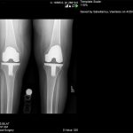 Παρουσίαση Περιπτώσεων