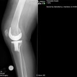 Παρουσίαση Περιπτώσεων