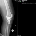 Παρουσίαση Περιπτώσεων