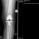 Παρουσίαση Περιπτώσεων