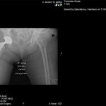 Παρουσίαση Περιπτώσεων