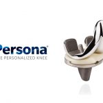 Εξατομικευμένα Εμφυτεύματα Στην Αρθροπλαστική Ισχίου