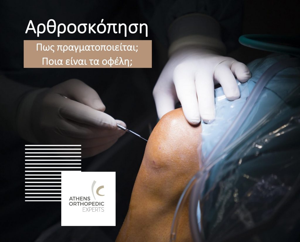 &Alpha;&rho;&theta;&rho;&omicron;&sigma;&kappa;ό&pi;&eta;&sigma;&eta; - &Pi;&omega;&sigmaf; &pi;&rho;&alpha;&gamma;&mu;&alpha;&tau;&omicron;&pi;&omicron;&iota;&epsilon;ί&tau;&alpha;&iota;; &Pi;&omicron;&iota;ά &epsilon;ί&nu;&alpha;&iota; &tau;&alpha; &omicron;&phi;έ&lambda;&eta;;