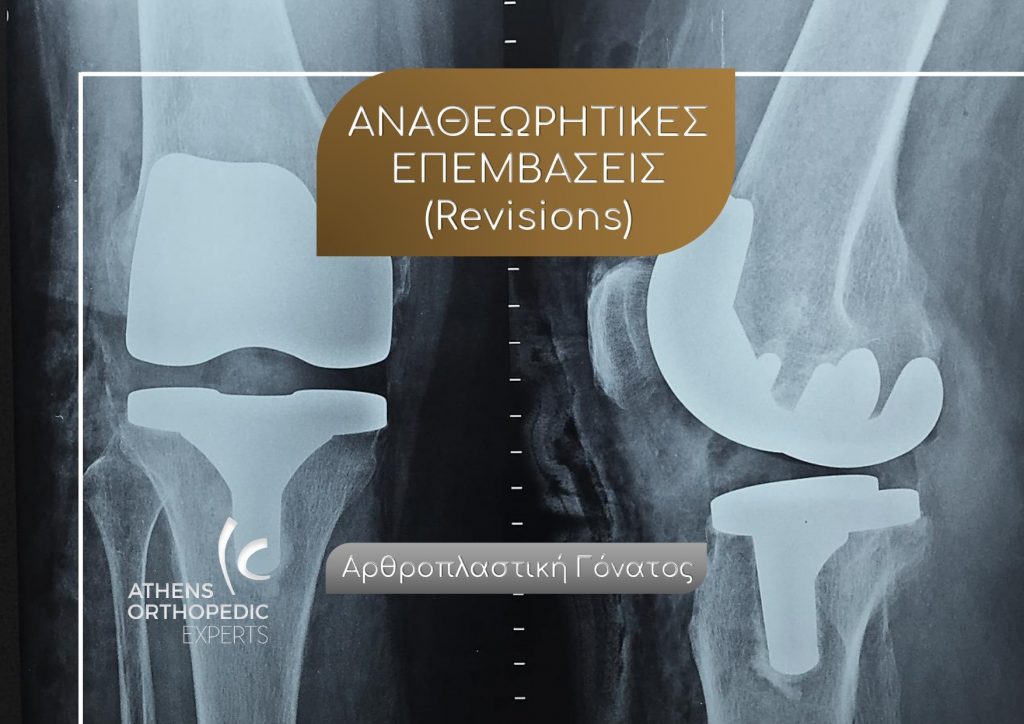 &Omicron; &rho;ό&lambda;&omicron;&sigmaf; &tau;&eta;&sigmaf; &alpha;&nu;&alpha;&theta;&epsilon;ώ&rho;&eta;&sigma;&eta;&sigmaf; (Revision) &tau;&eta;&sigmaf; &alpha;&rho;&theta;&rho;&omicron;&pi;&lambda;&alpha;&sigma;&tau;&iota;&kappa;ή&sigmaf; &sigma;&tau;&eta; &chi;&epsilon;&iota;&rho;&omicron;&upsilon;&rho;&gamma;&iota;&kappa;ή &tau;&omicron;&upsilon; &gamma;ό&nu;&alpha;&tau;&omicron;&sigmaf;