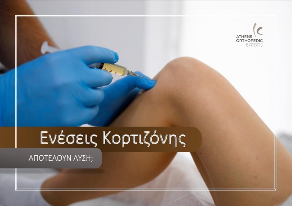 &Epsilon;&nu;έ&sigma;&epsilon;&iota;&sigmaf; &Kappa;&omicron;&rho;&tau;&iota;&zeta;ό&nu;&eta;&sigmaf;: &Epsilon;ί&nu;&alpha;&iota; &Lambda;ύ&sigma;&eta;;