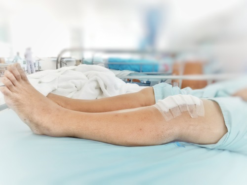 αρθροσκόπηση