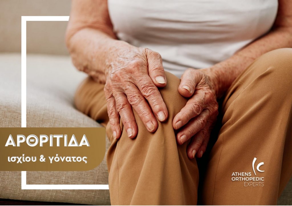 αρθρίτιδα